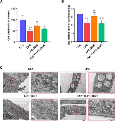 Berberine ameliorates septic cardiomyopathy through protecting mitochondria and upregulating Notch1 signaling in cardiomyocytes